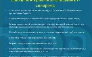 Что такое импиджмент-синдром плечевого сустава и как его лечить