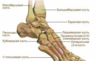 Что делать если болит подъем стопы и как его лечить