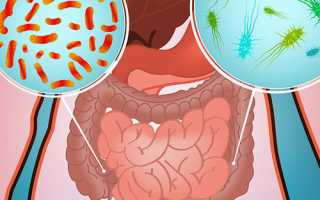 Вопросы и факты о кишечной микрофлоре