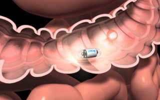 Проверка кишечника без колоноскопии: альтернативные методы исследования