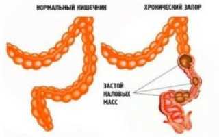 Почему болит низ живота после дефекации у женщин