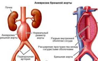 Что может шевелиться в животе если не беременна