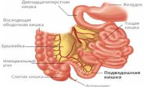 Заболевания подвздошной кишки: симптомы и признаки болезни, лечение