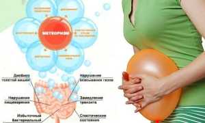 Причины вздутия живота и повышенного газообразования, методы лечения