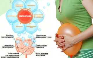 Причины вздутия живота и повышенного газообразования, методы лечения