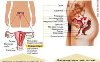 Почему болит спина в области копчика у женщин