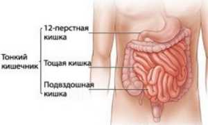 Заболевания тонкого кишечника: симптомы и признаки болезни, лечение