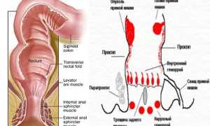 Заболевания прямой кишки: симптомы и признаки болезни, лечение