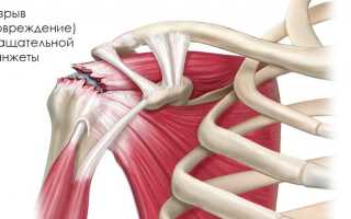 Почему болят сухожилия в двуглавой мышце плеча
