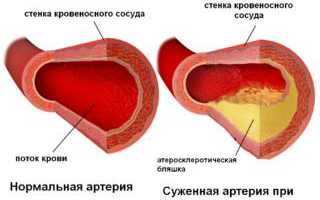 Почему ноют и крутит колени у женщин по ночам: причины и лечение