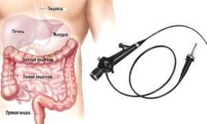 Эндоскопические методы обследования кишечника: описание и подготовка