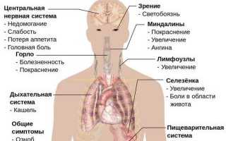 Почему желтеют ладони рук