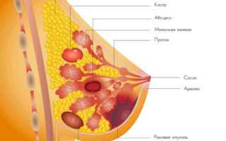 Что такое инволютивные изменения молочных желез