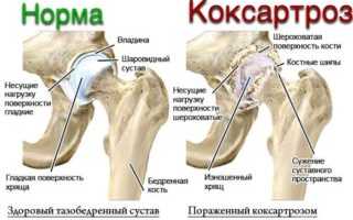 Болит нога в бедре: причины, диагностика и лечение