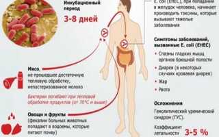 Эшерихиоз: подробно об инфекционном заболевании