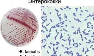 Энтерококки: о бактерии, нормальное и патологическое существование