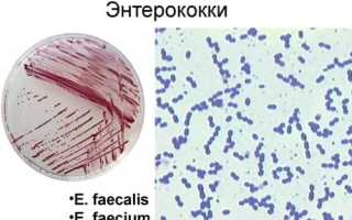 Энтерококки: о бактерии, нормальное и патологическое существование