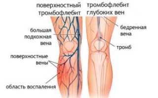 Ветви задней болшеберцовой артерии