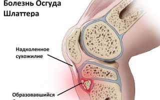 Кости голени и их соединения