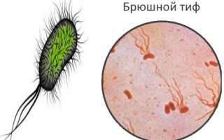 Подробно о брюшном тифе: симптомы, характеристика возбудителя, анализ и лечение
