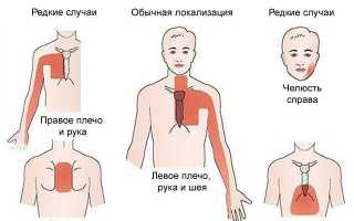 Жжет сердце почему