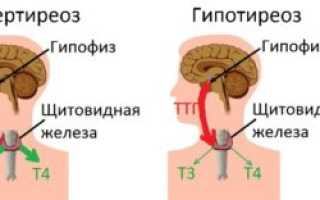 Что такое фиброзные изменения молочных желез и как их лечить