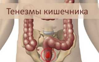 Почему возникают кишечные тенезмы и как их лечить?