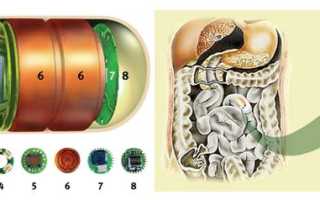 Как проводят капсульную эндоскопию кишечника?