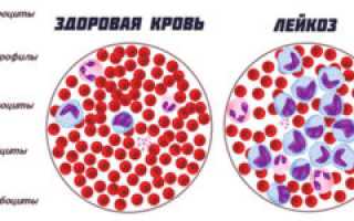 Почему увеличиваются подколенные лимфоузлы: причины воспаления и происхождение патологии