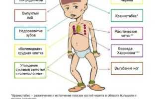 Почему одно ребро выпирает больше другого