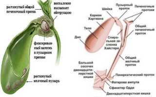 Список желчегонных препаратов при застое желчи