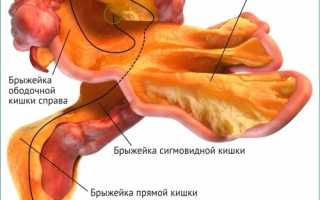 Что такое брыжейка кишечника, ее расположение и функции