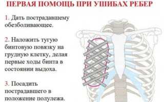 Что делать при ушибе ребер при падении: лечение в домашних условиях