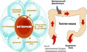 Какие препараты использовать при повышенном газообразовании?