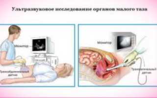 УЗИ вен малого таза: противопоказания, подготовка и техника выполнения