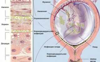 Уплотнения и шишки в груди у новорожденных