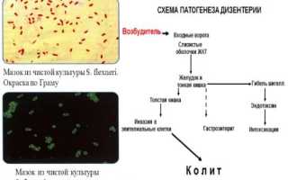 Возбудитель шигеллеза, его симптомы и лечение