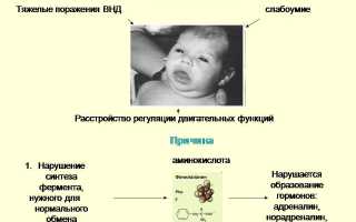 Диета при фенилкетонурии у детей