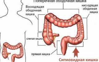 Сигмовидная кишка: расположение, строение, функции и заболевания органа