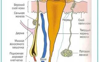 Как убрать мозоль на пальце