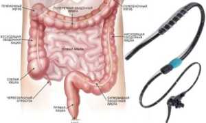 Основные методы энтероскопии и их проведение