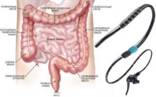 Основные методы энтероскопии и их проведение
