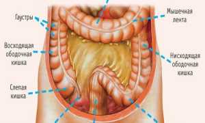 Сигмоидит (воспаление сигмовидной кишки): симптомы и методы лечения