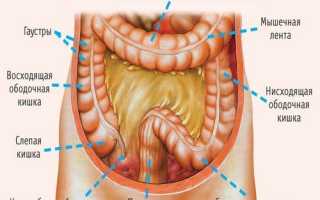 Сигмоидит (воспаление сигмовидной кишки): симптомы и методы лечения