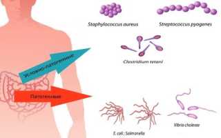 Представители патогенной микрофлоры кишечника