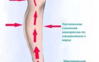 Компрессионные наколенники при варикозе: виды, особенности выбора и использования