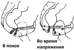 Anorektalnaja-oblast-v-pokoe-i-pri-naprjazhenii