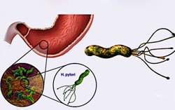 Бактерии Helicobacter pylori