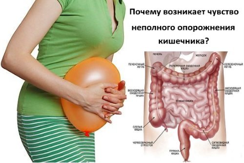 Chuvstvo-nepolnogo-oporozhnenija-kishechnika