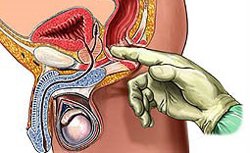 Диагностика заболеваний прямой кишки
